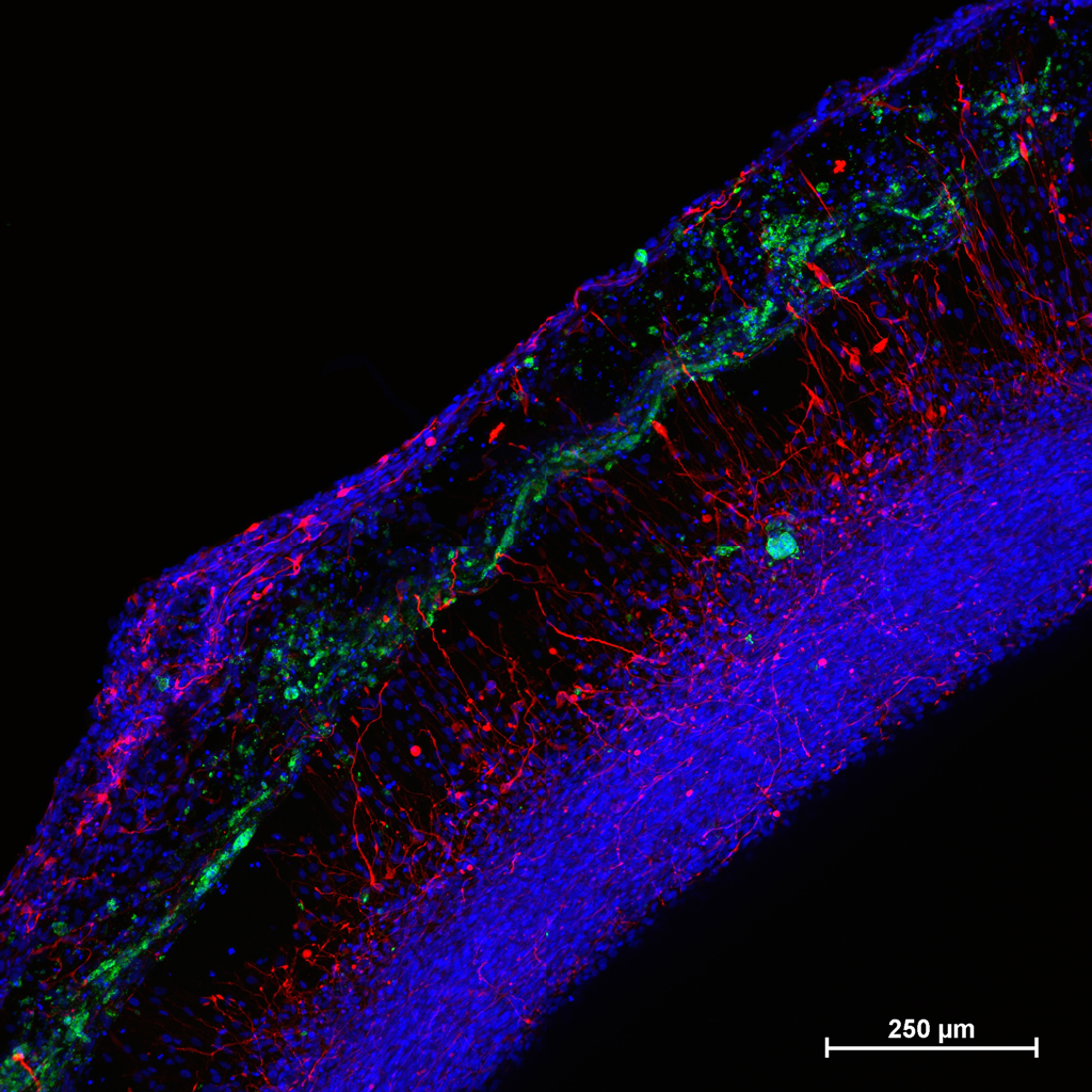 1.Neural-0.5mm-scale-bar